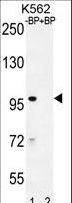 IQCA Antibody - Western blot of IQCA1 Antibody antibody pre-incubated without(lane 1) and with(lane 2) blocking peptide in K562 cell line lysate. IQCA1 Antibody (arrow) was detected using the purified antibody.
