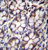 IQCA Antibody - IQCA1 Antibody immunohistochemistry of formalin-fixed and paraffin-embedded human rectum tissue followed by peroxidase-conjugated secondary antibody and DAB staining.