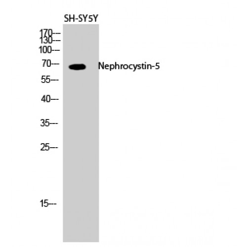 IQCB1 Antibody - Western blot of Nephrocystin-5 antibody