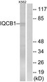 IQCB1 Antibody - Western blot analysis of lysates from K562 cells, using IQCB1 Antibody. The lane on the right is blocked with the synthesized peptide.