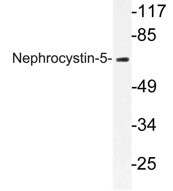 IQCB1 Antibody - Western blot of Nephrocystin-5 (R467) pAb in extracts from K562 cells.