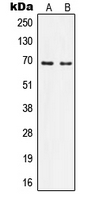 IQCB1 Antibody - Western blot analysis of Nephrocystin 5 expression in Ramos (A); HeLa (B) whole cell lysates.