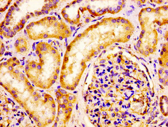 IQCB1 Antibody - Immunohistochemistry image at a dilution of 1:100 and staining in paraffin-embedded human kidney tissue performed on a Leica BondTM system. After dewaxing and hydration, antigen retrieval was mediated by high pressure in a citrate buffer (pH 6.0) . Section was blocked with 10% normal goat serum 30min at RT. Then primary antibody (1% BSA) was incubated at 4 °C overnight. The primary is detected by a biotinylated secondary antibody and visualized using an HRP conjugated SP system.