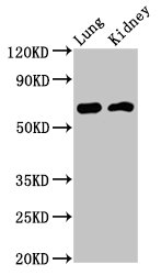IQCB1 Antibody - Positive Western Blot detected in Rat lung tissue, Mouse kidney tissue. All lanes: IQCB1 antibody at 3.2 µg/ml Secondary Goat polyclonal to rabbit IgG at 1/50000 dilution. Predicted band size: 69, 54, 35 KDa. Observed band size: 69 KDa
