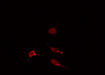 IQCB1 Antibody - Staining HeLa cells by IF/ICC. The samples were fixed with PFA and permeabilized in 0.1% Triton X-100, then blocked in 10% serum for 45 min at 25°C. The primary antibody was diluted at 1:200 and incubated with the sample for 1 hour at 37°C. An Alexa Fluor 594 conjugated goat anti-rabbit IgG (H+L) antibody, diluted at 1/600, was used as secondary antibody.