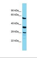 IQCC Antibody - Western blot of Human Placenta. IQCC antibody dilution 1.0 ug/ml.  This image was taken for the unconjugated form of this product. Other forms have not been tested.