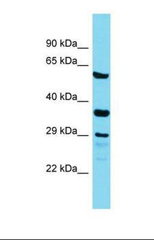 IQCC Antibody - Western blot of Human Placenta. IQCC antibody dilution 1.0 ug/ml.  This image was taken for the unconjugated form of this product. Other forms have not been tested.