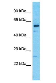 IQCC Antibody - IQCC antibody Western Blot of MCF7. Antibody dilution: 1 ug/ml.  This image was taken for the unconjugated form of this product. Other forms have not been tested.