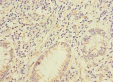 IQCC Antibody - Immunohistochemistry of paraffin-embedded human colon cancer using IQCC Antibody at dilution of 1:100