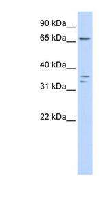 IQCE Antibody - IQCE antibody Western blot of Placenta lysate. This image was taken for the unconjugated form of this product. Other forms have not been tested.