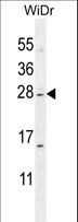 IQCF1 Antibody - IQCF1 Antibody western blot of WiDr cell line lysates (35 ug/lane). The IQCF1 antibody detected the IQCF1 protein (arrow).