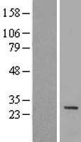 IQCF1 Protein - Western validation with an anti-DDK antibody * L: Control HEK293 lysate R: Over-expression lysate