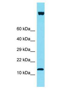 IQCF6 Antibody - IQCF6 antibody Western Blot of HT1080. Antibody dilution: 1 ug/ml.  This image was taken for the unconjugated form of this product. Other forms have not been tested.