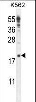 IQCJ Antibody - IQCJ Antibody western blot of K562 cell line lysates (35 ug/lane). The IQCJ antibody detected the IQCJ protein (arrow).