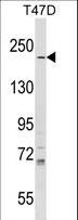 IQGAP1 Antibody - IQGAP1 Antibody western blot of T47D cell line lysates (35 ug/lane). The IQGAP1 antibody detected the IQGAP1 protein (arrow).