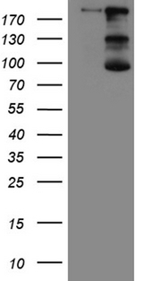 IQGAP1 Antibody - HEK293T cells were transfected with the pCMV6-ENTRY control. (Left lane) or pCMV6-ENTRY IQGAP1. (Right lane) cDNA for 48 hrs and lysed. Equivalent amounts of cell lysates. (5 ug per lane) were separated by SDS-PAGE and immunoblotted with anti-IQGAP1. (1:2000)