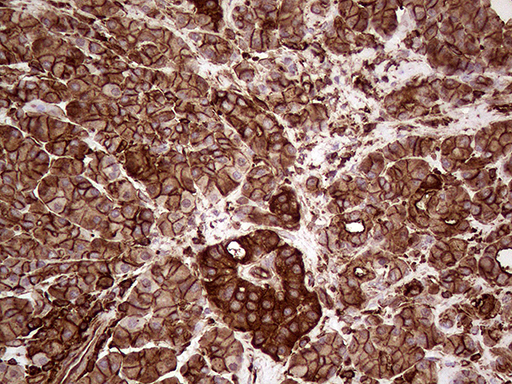 IQGAP1 Antibody - Immunohistochemical staining of paraffin-embedded Human pancreas tissue within the normal limits using anti-IQGAP1 mouse monoclonal antibody. (Heat-induced epitope retrieval by 1mM EDTA in 10mM Tris buffer. (pH8.5) at 120°C for 3 min. (1:5000)
