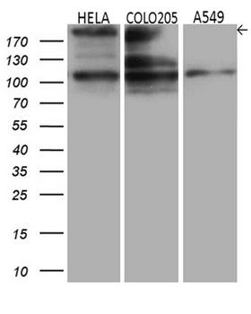 IQGAP1 Antibody - Western blot analysis of extracts. (35ug) from 3 different cell lines by using anti-IQGAP1 monoclonal antibody. (1:500)