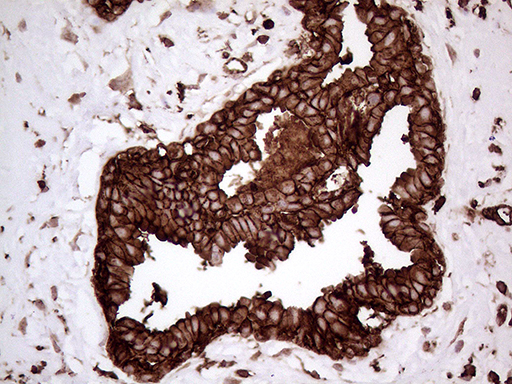 IQGAP1 Antibody - Immunohistochemical staining of paraffin-embedded Human breast tissue within the normal limits using anti-IQGAP1 mouse monoclonal antibody. (Heat-induced epitope retrieval by 1mM EDTA in 10mM Tris buffer. (pH8.5) at 120°C for 3 min. (1:5000)