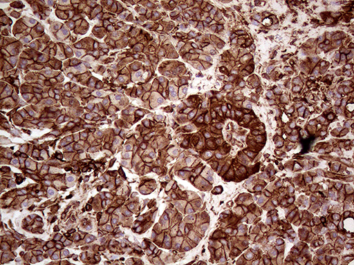 IQGAP1 Antibody - Immunohistochemical staining of paraffin-embedded Human pancreas tissue within the normal limits using anti-IQGAP1 mouse monoclonal antibody. (Heat-induced epitope retrieval by 1mM EDTA in 10mM Tris buffer. (pH8.5) at 120°C for 3 min. (1:5000)