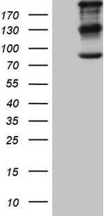 IQGAP1 Antibody - HEK293T cells were transfected with the pCMV6-ENTRY control. (Left lane) or pCMV6-ENTRY IQGAP1. (Right lane) cDNA for 48 hrs and lysed. Equivalent amounts of cell lysates. (5 ug per lane) were separated by SDS-PAGE and immunoblotted with anti-IQGAP1. (1:2000)