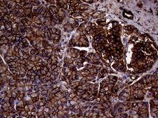 IQGAP1 Antibody - Immunohistochemical staining of paraffin-embedded Human pancreas tissue within the normal limits using anti-IQGAP1 mouse monoclonal antibody. (Heat-induced epitope retrieval by 1mM EDTA in 10mM Tris buffer. (pH8.5) at 120°C for 3 min. (1:2000)
