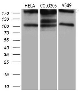 IQGAP1 Antibody - Western blot analysis of extracts. (35ug) from 3 different cell lines by using anti-IQGAP1 monoclonal antibody. (1:500)
