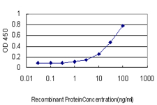 IQGAP1 Antibody - Detection limit for recombinant GST tagged IQGAP1 is approximately 3 ng/ml as a capture antibody.