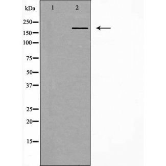 IQGAP1 Antibody - Western blot analysis of extracts of HeLa cells using IQGAP1 antibody. The lane on the left is treated with the antigen-specific peptide.