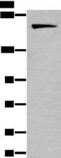 IQGAP1 Antibody - Western blot analysis of HUVEC cell lysate  using IQGAP1 Polyclonal Antibody at dilution of 1:300