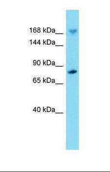 IQGAP2 Antibody - Western blot of Mouse Brain. Iqgap2 antibody dilution 1.0 ug/ml.  This image was taken for the unconjugated form of this product. Other forms have not been tested.