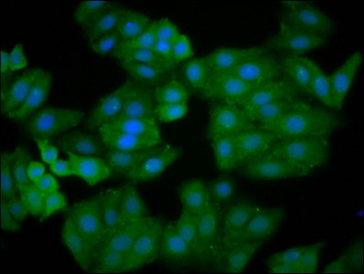 IQGAP2 Antibody - Immunofluorescence staining of HepG2 cells diluted at 1:166, counter-stained with DAPI. The cells were fixed in 4% formaldehyde, permeabilized using 0.2% Triton X-100 and blocked in 10% normal Goat Serum. The cells were then incubated with the antibody overnight at 4°C.The Secondary antibody was Alexa Fluor 488-congugated AffiniPure Goat Anti-Rabbit IgG (H+L).