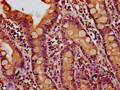 IQGAP2 Antibody - Immunohistochemistry Dilution at 1:500 and staining in paraffin-embedded human small intestine tissue performed on a Leica BondTM system. After dewaxing and hydration, antigen retrieval was mediated by high pressure in a citrate buffer (pH 6.0). Section was blocked with 10% normal Goat serum 30min at RT. Then primary antibody (1% BSA) was incubated at 4°C overnight. The primary is detected by a biotinylated Secondary antibody and visualized using an HRP conjugated SP system.