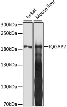 IQGAP2 Antibody - Western blot analysis of extracts of various cell lines, using IQGAP2 antibody at 1:1000 dilution. The secondary antibody used was an HRP Goat Anti-Rabbit IgG (H+L) at 1:10000 dilution. Lysates were loaded 25ug per lane and 3% nonfat dry milk in TBST was used for blocking. An ECL Kit was used for detection and the exposure time was 15s.