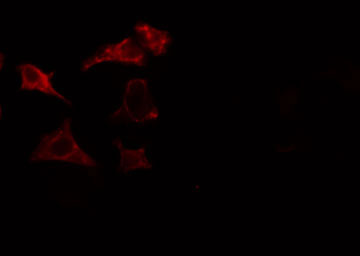 IQGAP3 Antibody - Staining HuvEc cells by IF/ICC. The samples were fixed with PFA and permeabilized in 0.1% Triton X-100, then blocked in 10% serum for 45 min at 25°C. The primary antibody was diluted at 1:200 and incubated with the sample for 1 hour at 37°C. An Alexa Fluor 594 conjugated goat anti-rabbit IgG (H+L) antibody, diluted at 1/600, was used as secondary antibody.