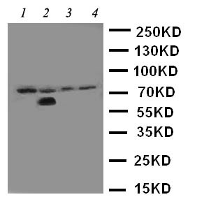 IRAK1 / IRAK Antibody - WB of IRAK1 / IRAK antibody. Lane 1: Rat Liver Tissue Lysate. Lane 2: Human Placenta Tissue Lysate. Lane 3: MCF-7 Cell Lysate. Lane 4: PANC Cell Lysate.