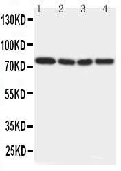IRAK1 / IRAK Antibody - Anti-IRAK antibody, Western blotting Lane 1: Rat Liver Tissue LysateLane 2: Human Placenta Tissue LysateLane 3: MCF-7 Cell LysateLane 4: PANC Cell Lysate