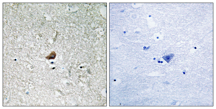 IRAK1 / IRAK Antibody - Immunohistochemistry analysis of paraffin-embedded human brain, using IRAK1 Antibody. The picture on the right is blocked with the synthesized peptide.