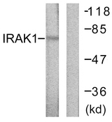 IRAK1 / IRAK Antibody - Western blot analysis of lysates from HeLa cells, using IRAK1 Antibody. The lane on the right is blocked with the synthesized peptide.