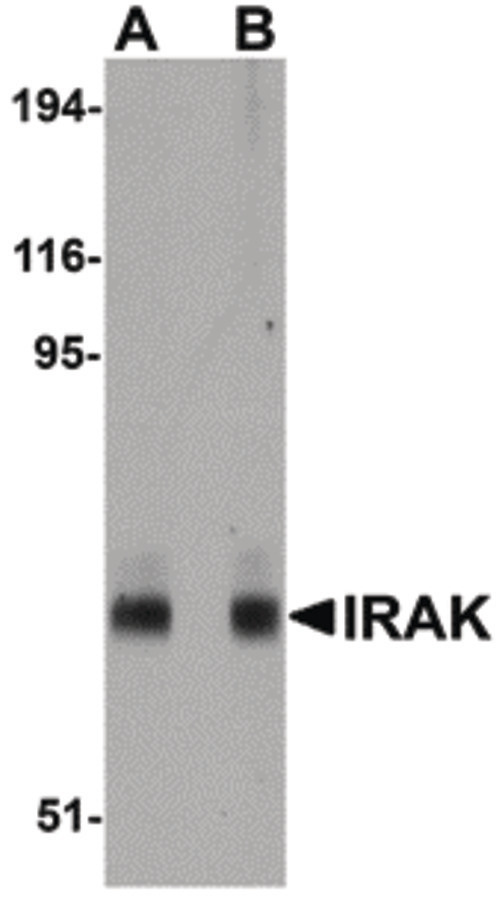 IRAK1 / IRAK Antibody - Western blot of IRAK in mouse liver lysate with IRAK antibody at (A) 1 and (B) 2 ug/ml.