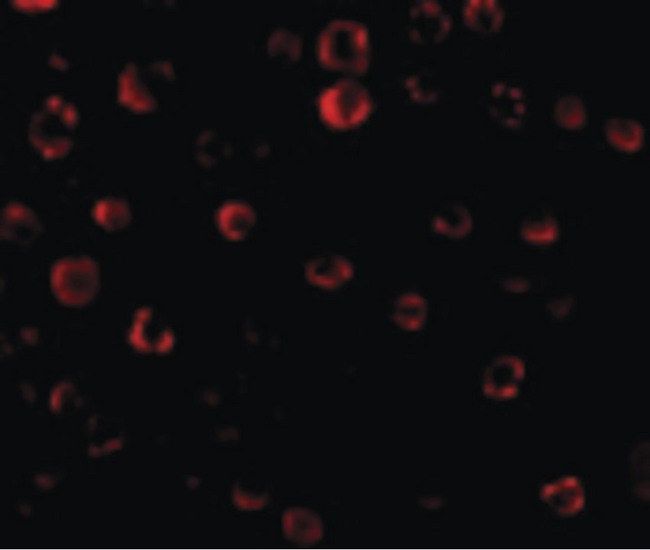 IRAK1 / IRAK Antibody - Immunofluorescence of IRAK in HeLa cells with IRAK antibody at 20 ug/ml.