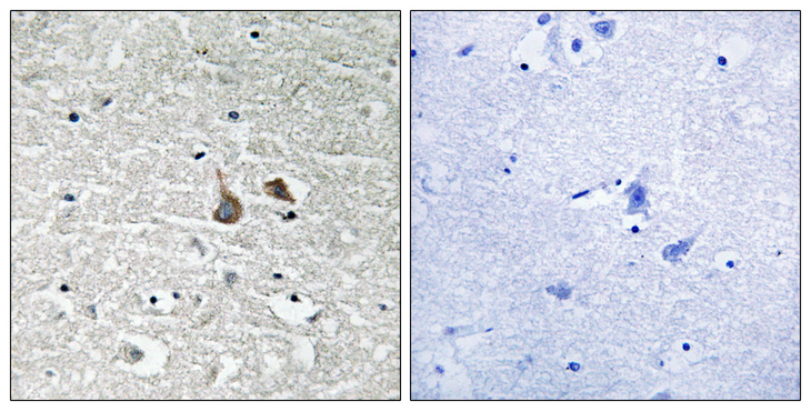 IRAK1 / IRAK Antibody - Immunohistochemistry analysis of paraffin-embedded human brain, using IRAK1 (Phospho-Ser376) Antibody. The picture on the right is blocked with the phospho peptide.