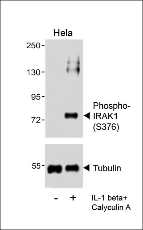 IRAK1 / IRAK Antibody - Western blot analysis of lysates from Hela cell line, untreated or treated with IL-1 beta (20ng/ml) + Calyculin A (100nM), using (upper) or Tubulin (lower).
