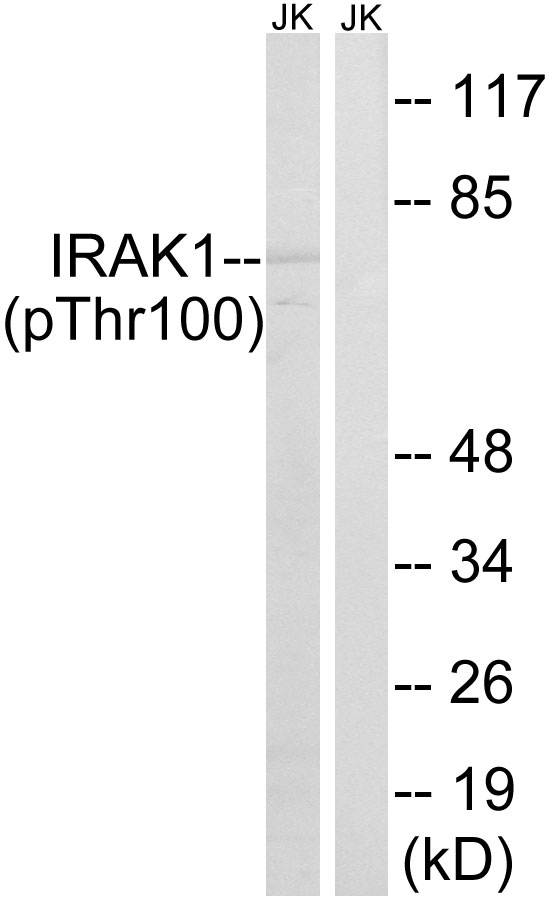 IRAK1 / IRAK Antibody - Western blot analysis of lysates from Jurkat cells treated with heat shock, using IRAK1 (Phospho-Thr100) Antibody. The lane on the right is blocked with the phospho peptide.
