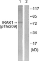 IRAK1 / IRAK Antibody - Western blot analysis of lysates from HeLa cells, using IRAK1 (Phospho-Thr209) Antibody. The lane on the right is blocked with the phospho peptide.