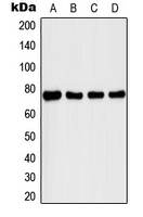 IRAK1 / IRAK Antibody - Western blot analysis of IRAK1 (pT209) expression in MCF7 IL1b-treated (A); K562 (B); MCF7 (C); Raw264.7 IL1b-treated (D) whole cell lysates.