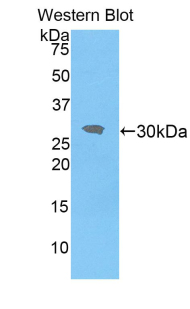 IRAK2 / IRAK-2 Antibody - Western blot of recombinant IRAK2 / IRAK-2.  This image was taken for the unconjugated form of this product. Other forms have not been tested.