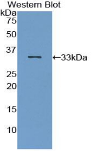 IRAK2 / IRAK-2 Antibody - Western blot of recombinant IRAK2 / IRAK-2.  This image was taken for the unconjugated form of this product. Other forms have not been tested.