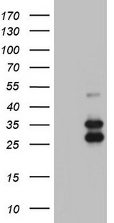 IRAK2 / IRAK-2 Antibody - HEK293T cells were transfected with the pCMV6-ENTRY control (Left lane) or pCMV6-ENTRY IRAK2 (Right lane) cDNA for 48 hrs and lysed. Equivalent amounts of cell lysates (5 ug per lane) were separated by SDS-PAGE and immunoblotted with anti-IRAK2.