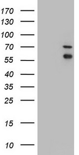 IRAK2 / IRAK-2 Antibody - HEK293T cells were transfected with the pCMV6-ENTRY control (Left lane) or pCMV6-ENTRY IRAK2 (Right lane) cDNA for 48 hrs and lysed. Equivalent amounts of cell lysates (5 ug per lane) were separated by SDS-PAGE and immunoblotted with anti-IRAK2.